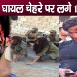 Saif Ali Khan injured in accident gets 100 stitches on his face